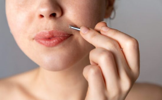 A young woman plucks her hair over her upper lip with tweezers. The concept of getting rid of unwanted facial hair. Close up.